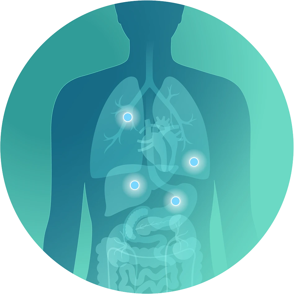 Illustration depicting how Mariana Oncology’s systemically delivered radioligand therapies precisely deliver radiation to cancer cells in the body