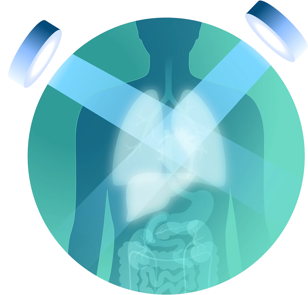 Illustration depicting traditional radiation therapy in which external beams are irradiating the lungs, heart, and liver